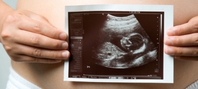 Д-р Петър Зарзаланов - Акушер-гинеколог Русе, Репродуктивна медицина Русе